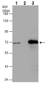 Immunoprecipitation - Anti-ZAP70 antibody (AB227237)