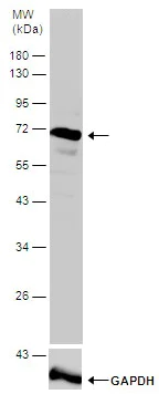 Western blot - Anti-ZAP70 antibody (AB227237)