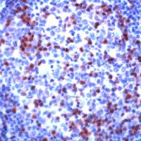 Immunohistochemistry (Formalin/PFA-fixed paraffin-embedded sections) - Anti-ZAP70 antibody - C-terminal (AB231452)