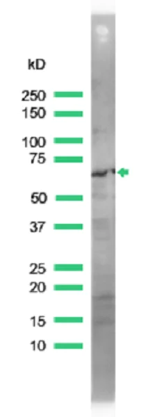 Western blot - Anti-ZAP70 antibody - C-terminal (AB231452)