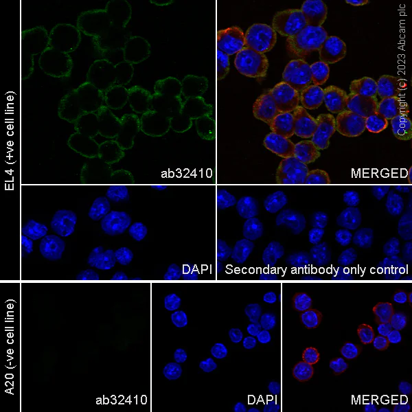 Immunocytochemistry/ Immunofluorescence - Anti-ZAP70 antibody [E267] (AB32410)