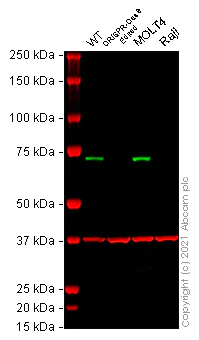 Western blot - Anti-ZAP70 antibody [E267] - BSA and Azide free (AB247256)