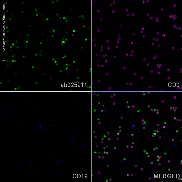 Immunocytochemistry/ Immunofluorescence - Anti-ZAP70 antibody [EPR29942-36] (AB325911)