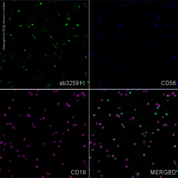 Immunocytochemistry/ Immunofluorescence - Anti-ZAP70 antibody [EPR29942-36] (AB325911)