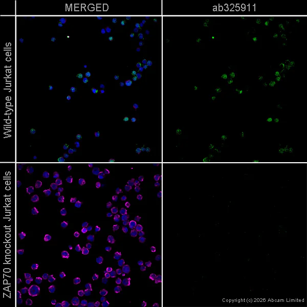 Immunocytochemistry/ Immunofluorescence - Anti-ZAP70 antibody [EPR29942-36] (AB325911)