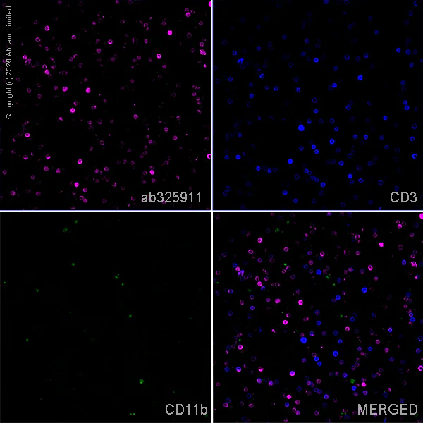 Immunocytochemistry/ Immunofluorescence - Anti-ZAP70 antibody [EPR29942-36] (AB325911)