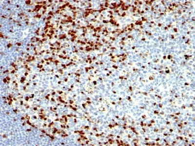 Immunohistochemistry (Formalin/PFA-fixed paraffin-embedded sections) - Anti-ZAP70 antibody [SPM362] (AB233985)