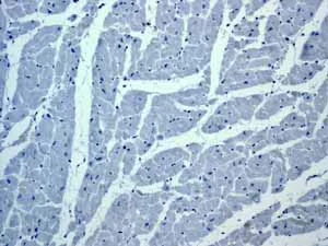 Immunohistochemistry (Formalin/PFA-fixed paraffin-embedded sections) - Anti-ZAP70 antibody [YE291] (AB32429)