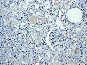 Immunohistochemistry (Formalin/PFA-fixed paraffin-embedded sections) - Anti-ZAP70 antibody [YE291] (AB32429)