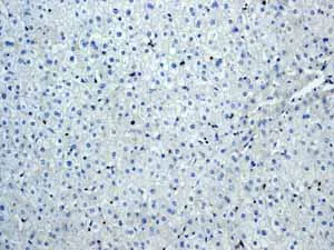 Immunohistochemistry (Formalin/PFA-fixed paraffin-embedded sections) - Anti-ZAP70 antibody [YE291] (AB32429)
