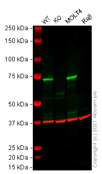 Western blot - Anti-ZAP70 antibody [YE291] (AB32429)
