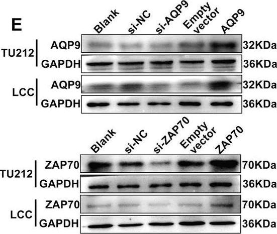 Western blot - Anti-ZAP70 antibody [YE291] (AB32429)