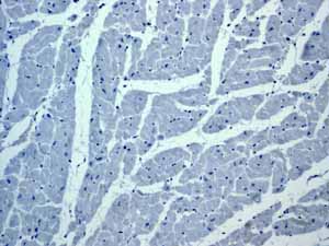 Immunohistochemistry (Formalin/PFA-fixed paraffin-embedded sections) - Anti-ZAP70 antibody [YE291] - BSA and Azide free (ab247258), expandable thumbnail