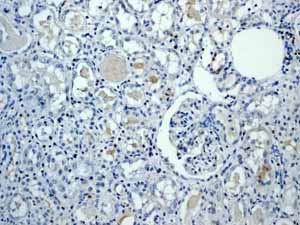Immunohistochemistry (Formalin/PFA-fixed paraffin-embedded sections) - Anti-ZAP70 antibody [YE291] - BSA and Azide free (ab247258), expandable thumbnail