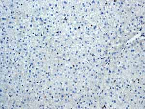Immunohistochemistry (Formalin/PFA-fixed paraffin-embedded sections) - Anti-ZAP70 antibody [YE291] - BSA and Azide free (ab247258), expandable thumbnail