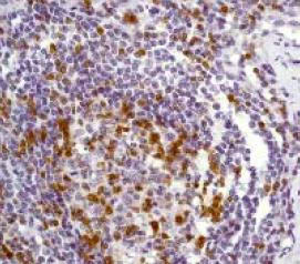 Immunohistochemistry (Formalin/PFA-fixed paraffin-embedded sections) - Anti-ZAP70 antibody [YE291] - BSA and Azide free (AB247258)
