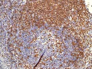 Immunohistochemistry (Formalin/PFA-fixed paraffin-embedded sections) - Anti-ZAP70 antibody [YE291] - BSA and Azide free (ab247258), expandable thumbnail