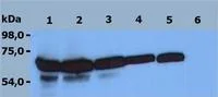 Western blot - Anti-ZAP70 antibody [ZAP-03] (AB38871)