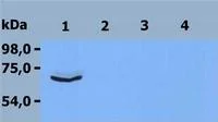 Western blot - Anti-ZAP70 antibody [ZAP-03] (AB38871)