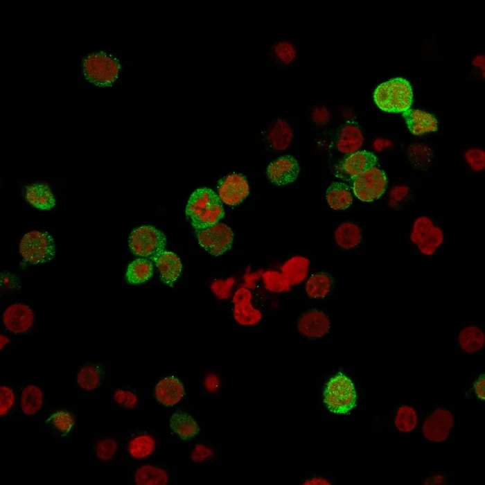 Immunocytochemistry - Anti-ZAP70 antibody [ZAP70/2035] - BSA and Azide free (AB237930)