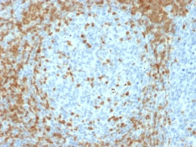 Immunohistochemistry (Formalin/PFA-fixed paraffin-embedded sections) - Anti-ZAP70 antibody [ZAP70/2035] - BSA and Azide free (AB237930)