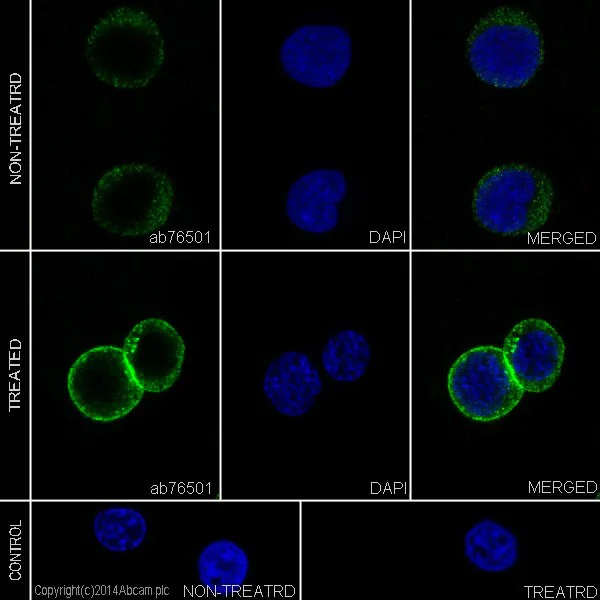 Immunocytochemistry/ Immunofluorescence - Anti-ZAP70 (phospho Y292) antibody [EPR1073] (AB76501)