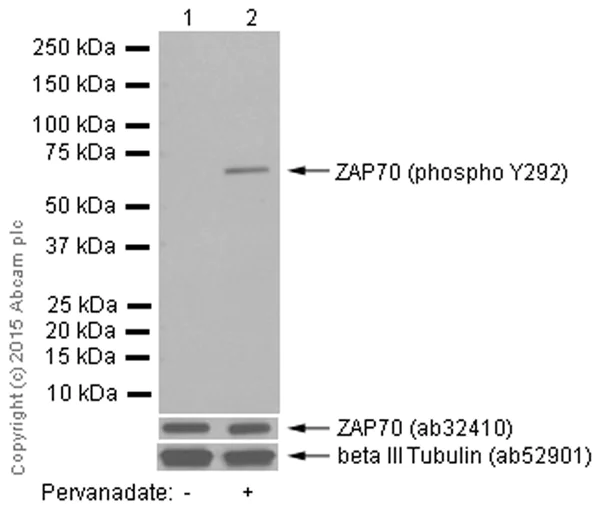 Western blot - Anti-ZAP70 (phospho Y292) antibody [EPR1073] - BSA and Azide free (AB247483)