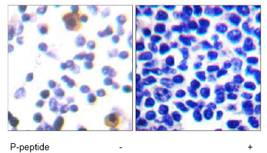 Immunohistochemistry (Formalin/PFA-fixed paraffin-embedded sections) - Anti-ZAP70 (phospho Y315) antibody (AB60970)