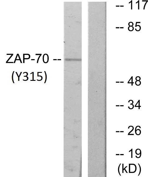 Western blot - Anti-ZAP70 (phospho Y315) antibody (AB60970)