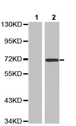 Western blot - Anti-ZAP70 (phospho Y319) antibody (AB194792)