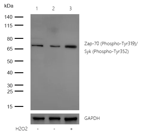 Western blot - Anti-ZAP70 (phospho Y319) + Syk (phospho Y352) antibody [SR4367] (AB326681)