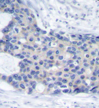 Immunohistochemistry (Formalin/PFA-fixed paraffin-embedded sections) - Anti-ZAP70 (phospho Y493) antibody (AB194800)