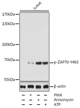 Western blot - Anti-ZAP70 (phospho Y493) antibody (AB194800)