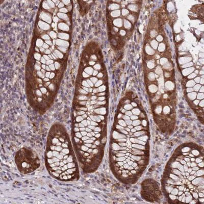 Immunohistochemistry (Formalin/PFA-fixed paraffin-embedded sections) - Anti-ZASC1 antibody (AB185106)