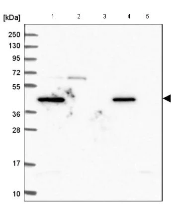 Western blot - Anti-ZASC1 antibody (AB185106)