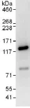 Immunoprecipitation - Anti-ZBT10 antibody (AB117786)