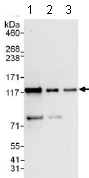 Western blot - Anti-ZBT10 antibody (AB117786)