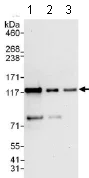 Western blot - Anti-ZBT10 antibody (AB117786)