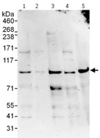 Western blot - Anti-ZBTB1 antibody (AB115170)