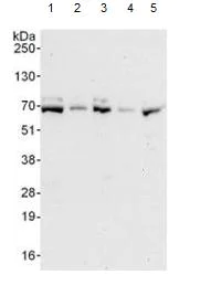 Western blot - Anti-ZBTB2 antibody (AB117756)