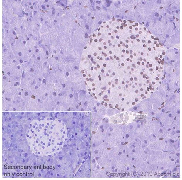Immunohistochemistry (Formalin/PFA-fixed paraffin-embedded sections) - Anti-ZBTB20 antibody [4A3] (AB243143), expandable thumbnail