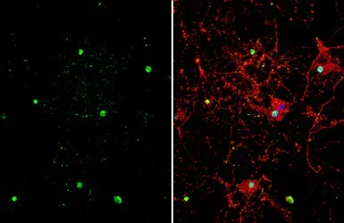 Immunocytochemistry/ Immunofluorescence - Anti-ZBTB20 antibody (AB127702)
