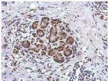 Immunohistochemistry (Formalin/PFA-fixed paraffin-embedded sections) - Anti-ZBTB20 antibody (AB127702), expandable thumbnail