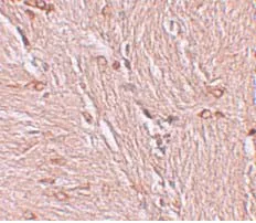 Immunohistochemistry (Formalin/PFA-fixed paraffin-embedded sections) - Anti-ZBTB4 antibody (AB106554)
