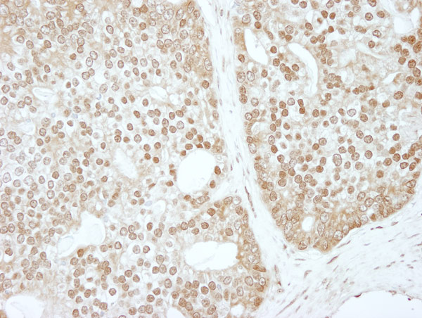 Immunohistochemistry (Formalin/PFA-fixed paraffin-embedded sections) - Anti-ZBTB40 antibody (AB86330)
