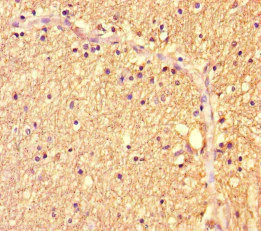 Immunohistochemistry (Formalin/PFA-fixed paraffin-embedded sections) - Anti-ZBTB46 antibody (AB222830)