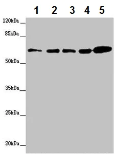 Western blot - Anti-ZBTB46 antibody (AB222830)