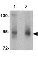 Western blot - Anti-ZBTB5 antibody (AB106562), expandable thumbnail