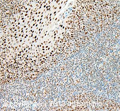 Immunohistochemistry (Formalin/PFA-fixed paraffin-embedded sections) - Anti-ZBTB7A antibody (AB70208)