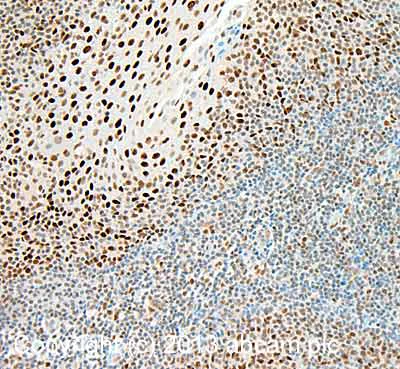 Immunohistochemistry (Formalin/PFA-fixed paraffin-embedded sections) - Anti-ZBTB7A antibody (AB70208)